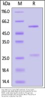 Anti-SARS-CoV-2 Spike RBD Antibody, Chimeric mAb, Human IgG1 (10B1A5) (BA.2&BA.4&BA.5/Omicron Specific) (MALS verified)