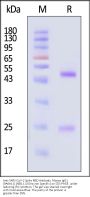 Anti-SARS-CoV-2 Spike RBD Antibody, Mouse IgG1 (9A6A11) (XBB.1.5/Omicron Specific) (MALS verified)