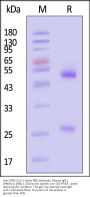 Anti-SARS-CoV-2 Spike RBD Antibody, Mouse IgG1 (9A6A11) (XBB.1.5/Omicron Specific)