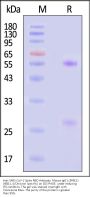 Anti-SARS-CoV-2 Spike RBD Antibody, Mouse IgG1 (5F8E1) (XBB.1.5/Omicron Specific)
