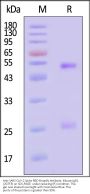 Anti-SARS-CoV-2 Spike RBD Broadly Antibody, Mouse IgG1 (2G7F5) (MALS verified)