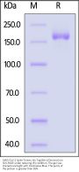 SARS-CoV-2 Spike Trimer Protein, His Tag (BA.1/Omicron) (MALS verified)