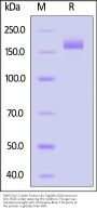 SARS-CoV-2 Spike Trimer Protein, His Tag (BA.2/Omicron) (MALS verified)