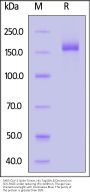 SARS-CoV-2 Spike Trimer Protein, His Tag (BA.5/Omicron) (MALS verified)