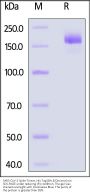 SARS-CoV-2 Spike Trimer Protein, His Tag (BA.5/Omicron) (Trehalose free) (MALS verified)