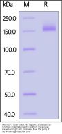 SARS-CoV-2 Spike Trimer Protein, His Tag (BA.4.6/Omicron) (MALS verified)
