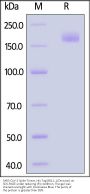 SARS-CoV-2 Spike Trimer Protein, His Tag (BQ.1.1/Omicron) (MALS verified)