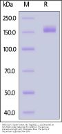 SARS-CoV-2 Spike Trimer Protein, His Tag (BQ.1.1.11/Omicron) (MALS verified)