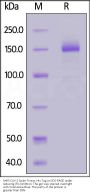SARS-CoV-2 Spike Trimer Protein (T19R, G142D, EF156-157del, R158G, L452R, T478K, D614G, P681R, D950N), His Tag (MALS verified)