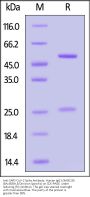 Anti-SARS-CoV-2 Spike Antibody, Human IgG1 (9A5E10) (BA.4&BA.5/Omicron Specific) (MALS verified)
