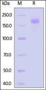SARS-CoV BtKY72 Spike Trimer Protein (K669A, KV971-972PP), His Tag