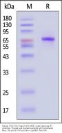 Human STAT3 Protein, His Tag (MALS & SPR verified)