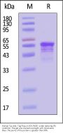 Human Tau-441 / 2N4R Protein, Tag Free, low endotoxin (MALS verified)