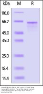 Human Tau-441 / 2N4R (P301S) Protein, His Tag, low endotoxin (MALS verified)