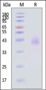 Biotinylated Human TEM8 / ANTXR1 Protein, His,Avitag™