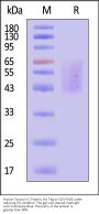 Human Tenascin-C Protein, His Tag