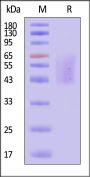 Human Tenascin-C Protein, His Tag