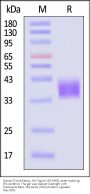 Human Coagulation Factor III / Tissue Factor Protein, His Tag (active enzyme, MALS verified)
