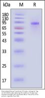Biotinylated Mouse Transferrin R / CD71 Protein, Avitag™,His Tag (MALS verified)