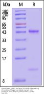 Human Latent TGF-beta 2 / TGFB2 Protein, His Tag