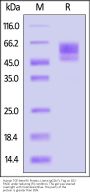 Human TGF-beta RII / TGFBR2 Protein, Llama IgG2b Fc Tag, low Endotoxin (MALS verified)