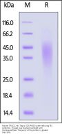 Human TRGC2 Protein, His Tag