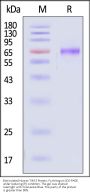 Biotinylated Human TIM-3 / HAVCR2 Protein, Fc,Avitag™ (MALS verified)