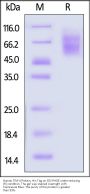 Human TIM-4 / TIMD4 Protein, His Tag