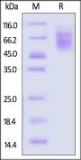 Human TIM-4 / TIMD4 Protein, His Tag