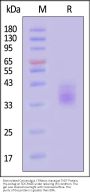 Biotinylated Cynomolgus / Rhesus macaque TIGIT Protein, His,Avitag™ (MALS verified)