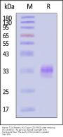 Human TL1A / TNFSF15 Protein, His Tag (MALS verified)