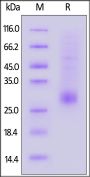 Human TL1A / TNFSF15 Protein, His Tag