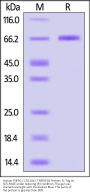 Human TNFR2 / CD120b / TNFRSF1B Protein, Fc Tag (MALS verified)