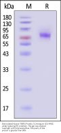 Biotinylated Human TNFR2 / CD120b / TNFRSF1B Protein, Fc,Avitag™ (MALS verified)