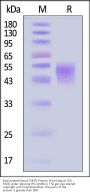 Biotinylated Mouse TNFR2 / CD120b / TNFRSF1B Protein, His,Avitag™ (MALS verified)