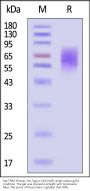 Rat TPBG / 5T4 Protein, His Tag (MALS verified)