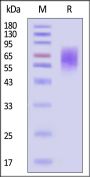 Rat TPBG / 5T4 Protein, His Tag (MALS verified)