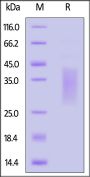 Human TRGC1 Protein, His Tag