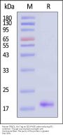 Human TRBC1 Protein, His Tag (HPLC verified)