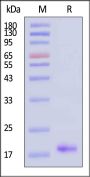Human TRBC1 Protein, His Tag (HPLC verified)
