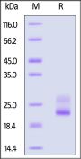 Biotinylated Human TRBC1 Protein, His,Avitag™