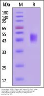 Cynomolgus TROP-2 / TACSTD2 Protein, His Tag (MALS verified)