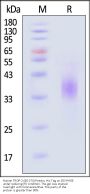 Human TROP-2 / TACSTD2 (88-274) Protein, His Tag (MALS verified)