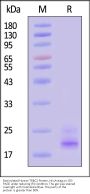 Biotinylated Human TRBC2 Protein, His,Avitag™