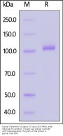 Human Transferrin R2 alpha Protein, Fc Tag