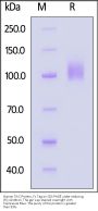 Human TrkC / NTRK3 Protein, Fc Tag (MALS verified)