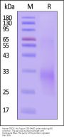 Human TRDC Protein, His Tag