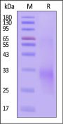 Human TRDC Protein, His Tag