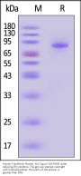 Human Transferrin Protein, His Tag (MALS verified)