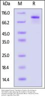 Biotinylated Human Transferrin Protein, His,Avitag™ (MALS verified)
